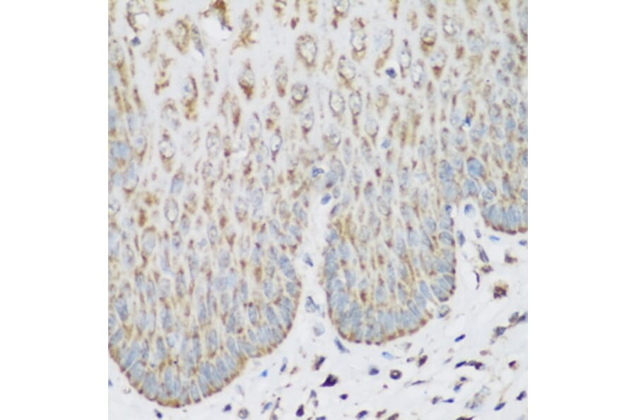 Immunohistochemistry - Anti-IMP3 Antibody (A11751) - Antibodies.com