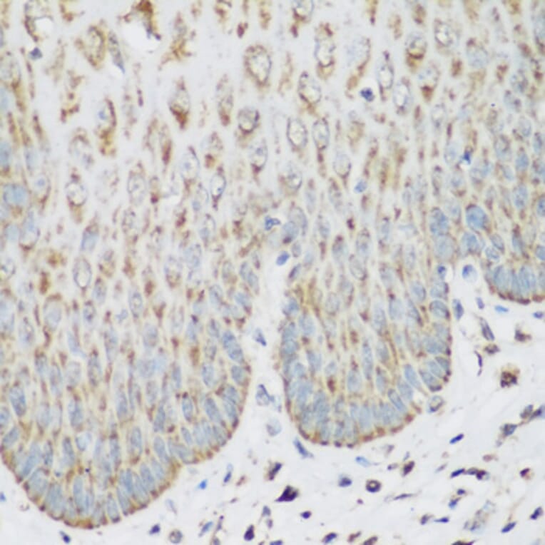 Immunohistochemistry - Anti-IMP3 Antibody (A11751) - Antibodies.com