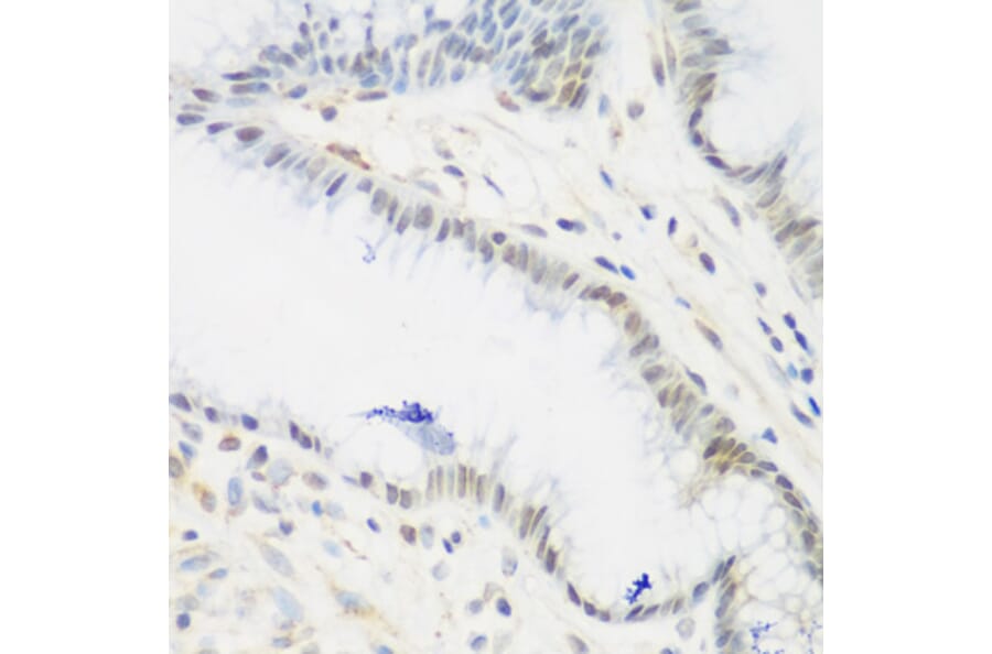 Immunohistochemistry - Anti-IMP3 Antibody (A11751) - Antibodies.com
