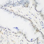 Immunohistochemistry - Anti-IMP3 Antibody (A11751) - Antibodies.com
