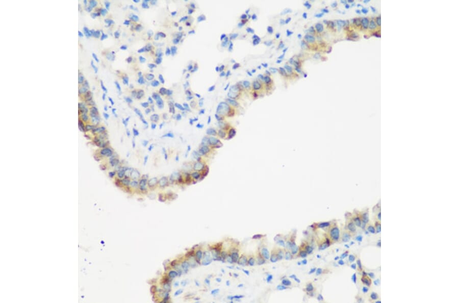 Immunohistochemistry - Anti-IMP3 Antibody (A11751) - Antibodies.com