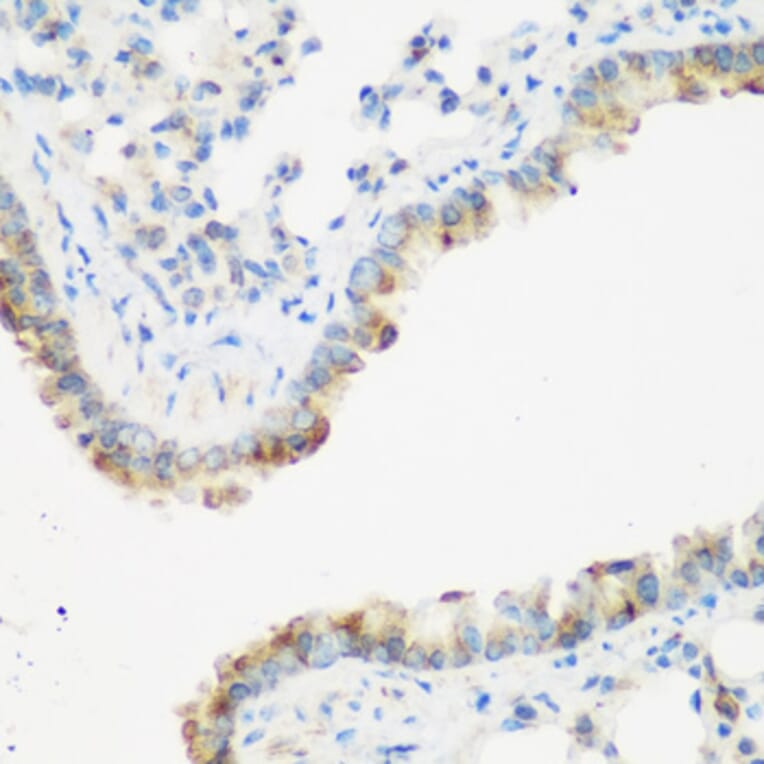 Immunohistochemistry - Anti-IMP3 Antibody (A11751) - Antibodies.com