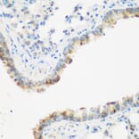 Immunohistochemistry - Anti-IMP3 Antibody (A11751) - Antibodies.com