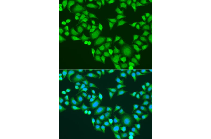 Immunofluorescence - Anti-IMP3 Antibody (A11751) - Antibodies.com