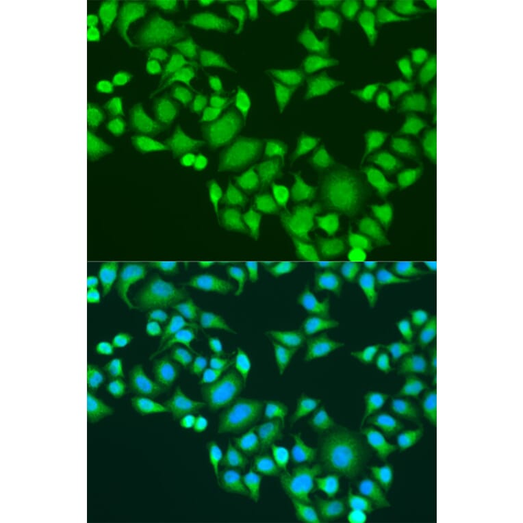 Immunofluorescence - Anti-IMP3 Antibody (A11751) - Antibodies.com