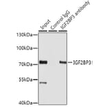 Western Blot - Anti-IMP3 Antibody (A11751) - Antibodies.com