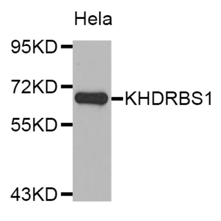 Western Blot - Anti-KHDRBS1 Antibody (A4446) - Antibodies.com