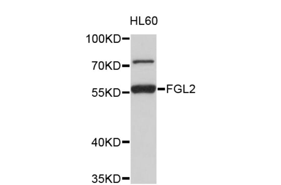 Western Blot - Anti-FGL2 Antibody (A4458) - Antibodies.com