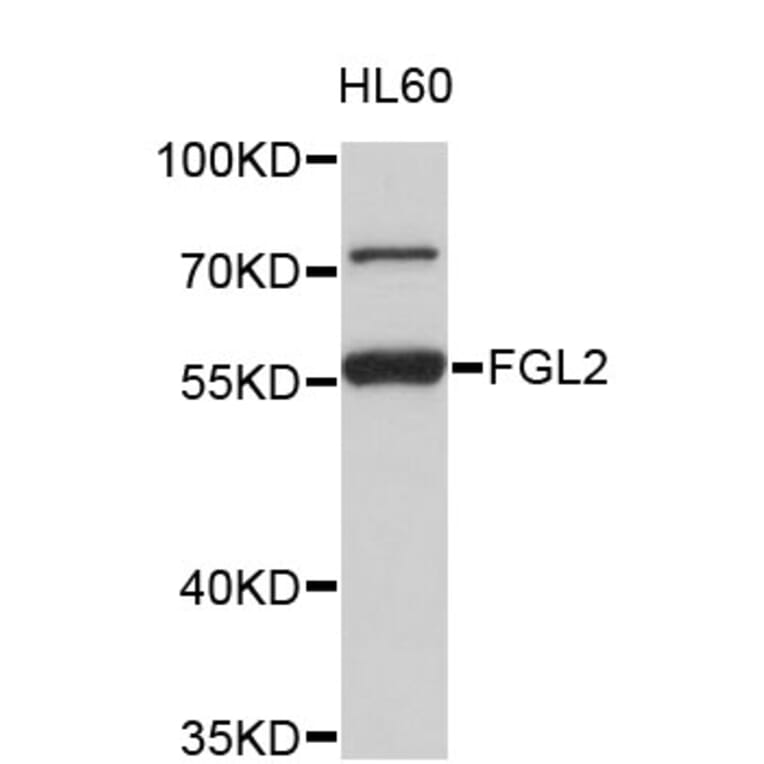 Western Blot - Anti-FGL2 Antibody (A4458) - Antibodies.com