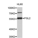Western Blot - Anti-FGL2 Antibody (A4458) - Antibodies.com