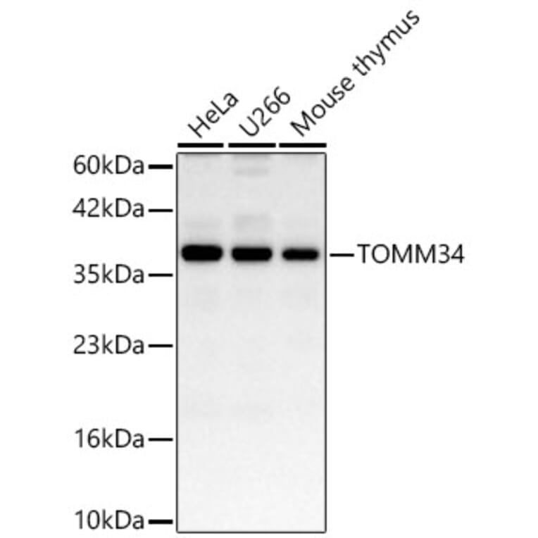 Western Blot - Anti-TOMM34 Antibody (A11754) - Antibodies.com