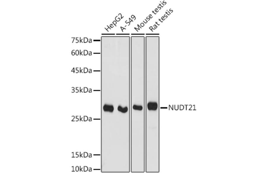Western Blot - Anti-NUDT21/CFIM25 Antibody (A11755) - Antibodies.com