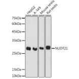 Western Blot - Anti-NUDT21/CFIM25 Antibody (A11755) - Antibodies.com