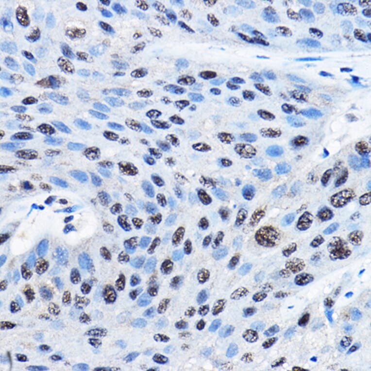 Immunohistochemistry - Anti-NUDT21/CFIM25 Antibody (A11755) - Antibodies.com