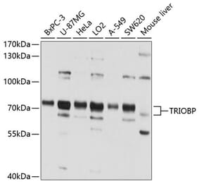 Western Blot - Anti-TRIOBP Antibody (A11756) - Antibodies.com