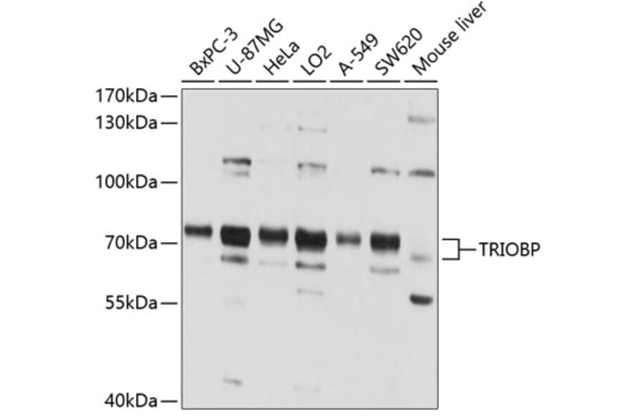 Western Blot - Anti-TRIOBP Antibody (A11756) - Antibodies.com