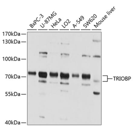 Western Blot - Anti-TRIOBP Antibody (A11756) - Antibodies.com