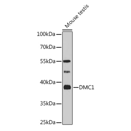 Western Blot - Anti-DMC1 Antibody (A11757) - Antibodies.com