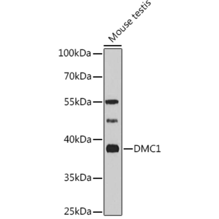 Western Blot - Anti-DMC1 Antibody (A11757) - Antibodies.com