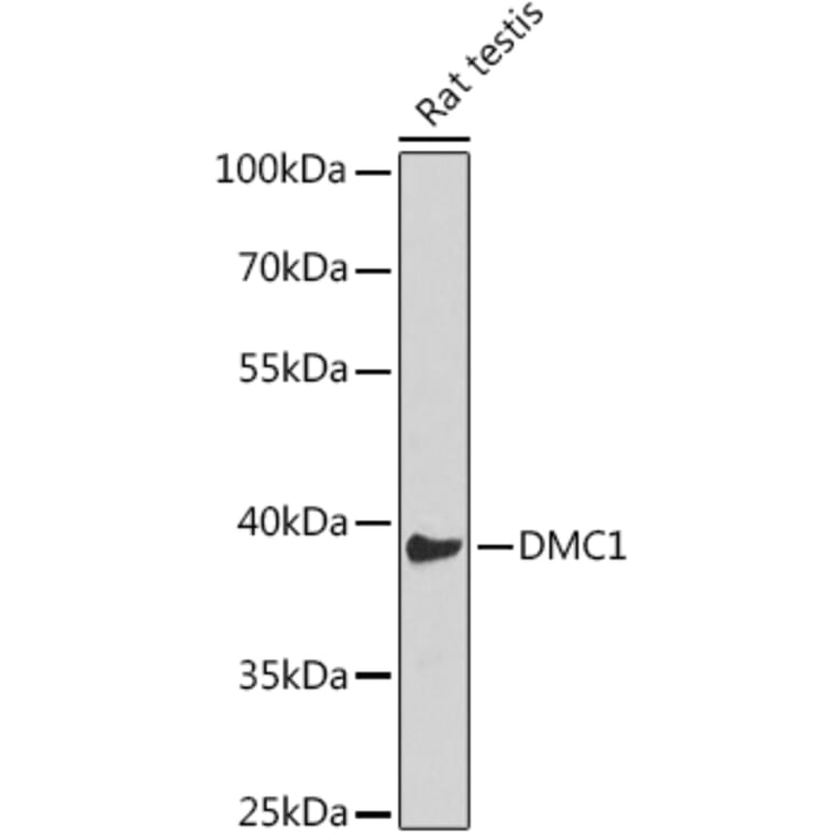 Western Blot - Anti-DMC1 Antibody (A11757) - Antibodies.com