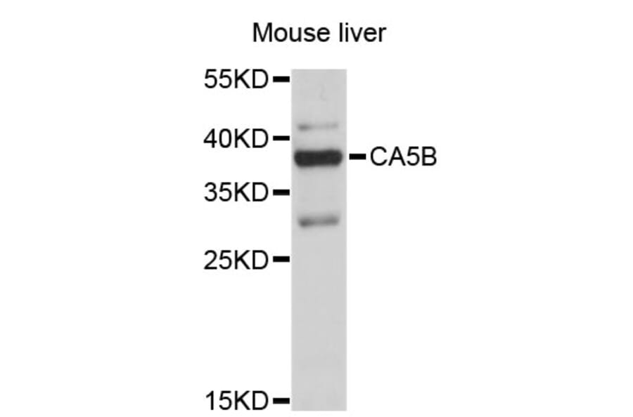 Western Blot - Anti-CA5B Antibody (A4495) - Antibodies.com