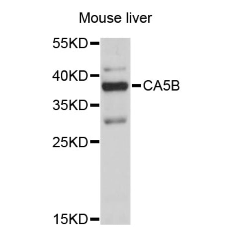 Western Blot - Anti-CA5B Antibody (A4495) - Antibodies.com