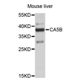 Western Blot - Anti-CA5B Antibody (A4495) - Antibodies.com