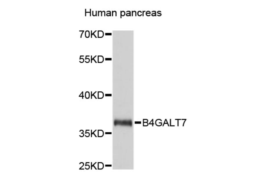 Western Blot - Anti-B4GALT7 Antibody (A4500) - Antibodies.com