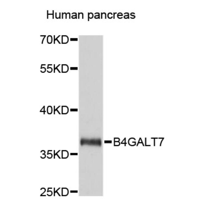 Western Blot - Anti-B4GALT7 Antibody (A4500) - Antibodies.com
