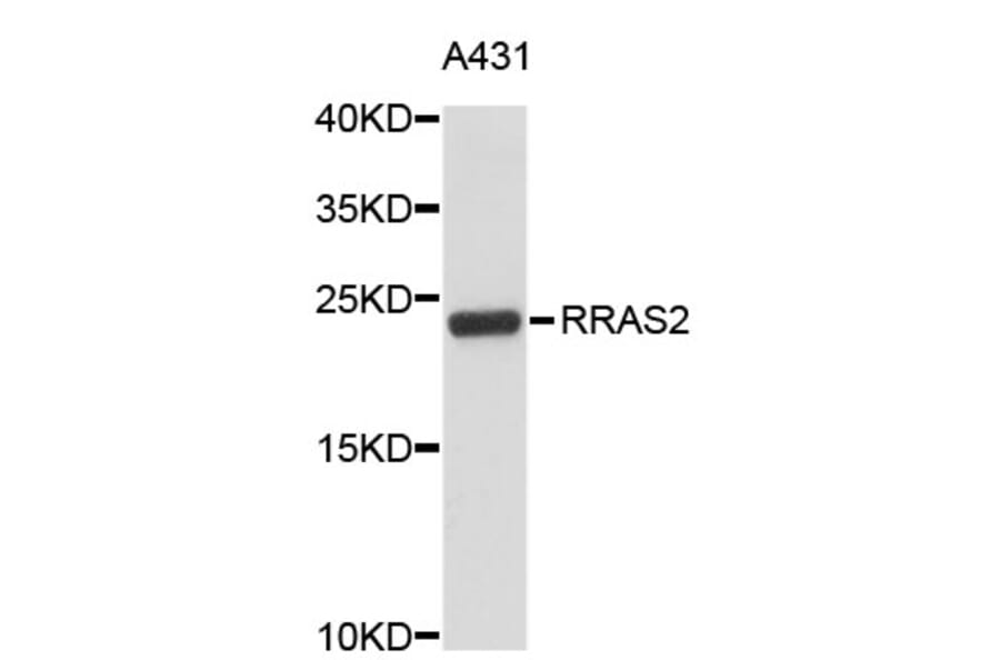 Western Blot - Anti-RRAS2 Antibody (A4509) - Antibodies.com
