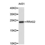 Western Blot - Anti-RRAS2 Antibody (A4509) - Antibodies.com