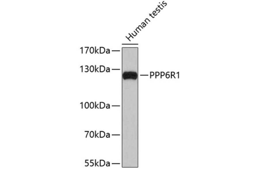 Western Blot - Anti-PPP6R1 Antibody (A4515) - Antibodies.com