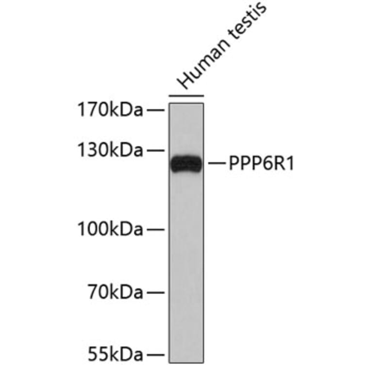 Western Blot - Anti-PPP6R1 Antibody (A4515) - Antibodies.com