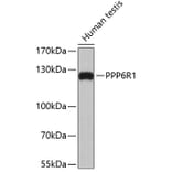 Western Blot - Anti-PPP6R1 Antibody (A4515) - Antibodies.com