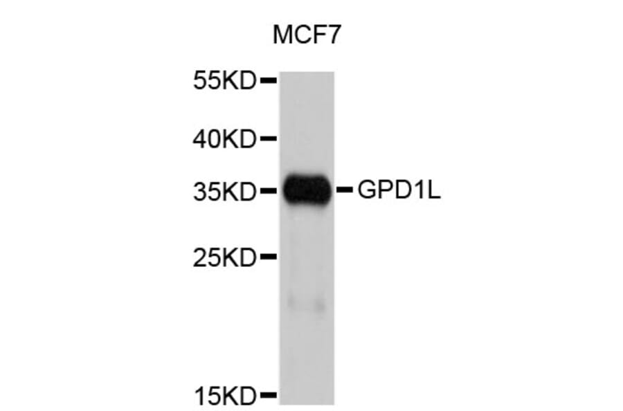 Western Blot - Anti-GPD1L Antibody (A4530) - Antibodies.com