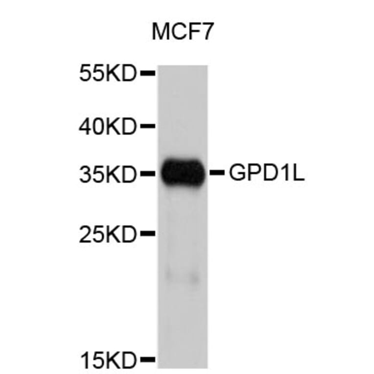 Western Blot - Anti-GPD1L Antibody (A4530) - Antibodies.com