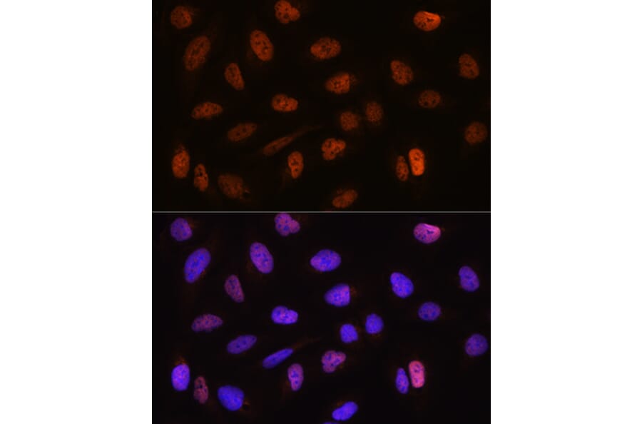 Immunofluorescence - Anti-CSTF2T Antibody (A11764) - Antibodies.com