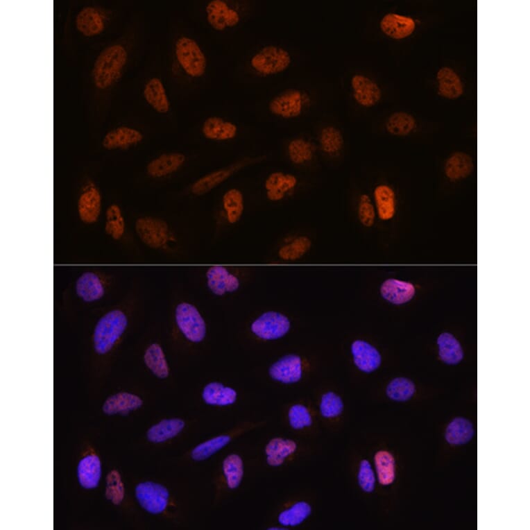 Immunofluorescence - Anti-CSTF2T Antibody (A11764) - Antibodies.com