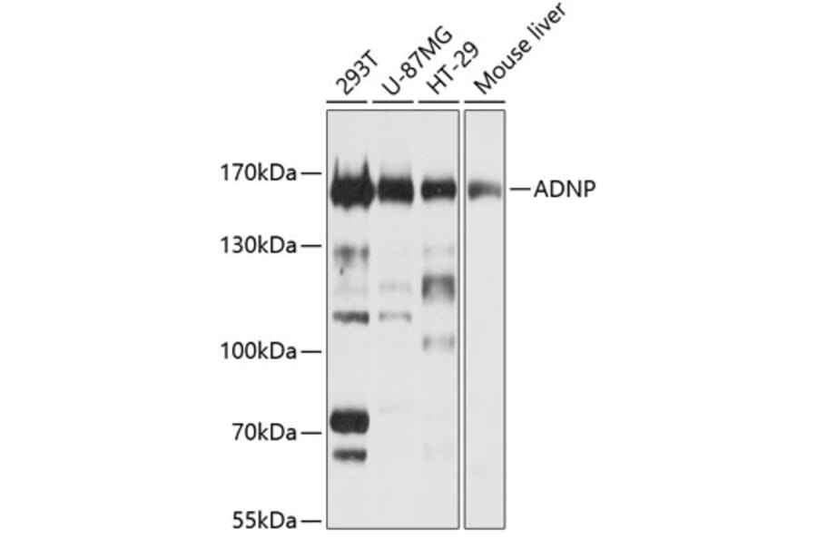 Western Blot - Anti-ADNP Antibody (A11766) - Antibodies.com
