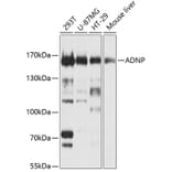 Western Blot - Anti-ADNP Antibody (A11766) - Antibodies.com