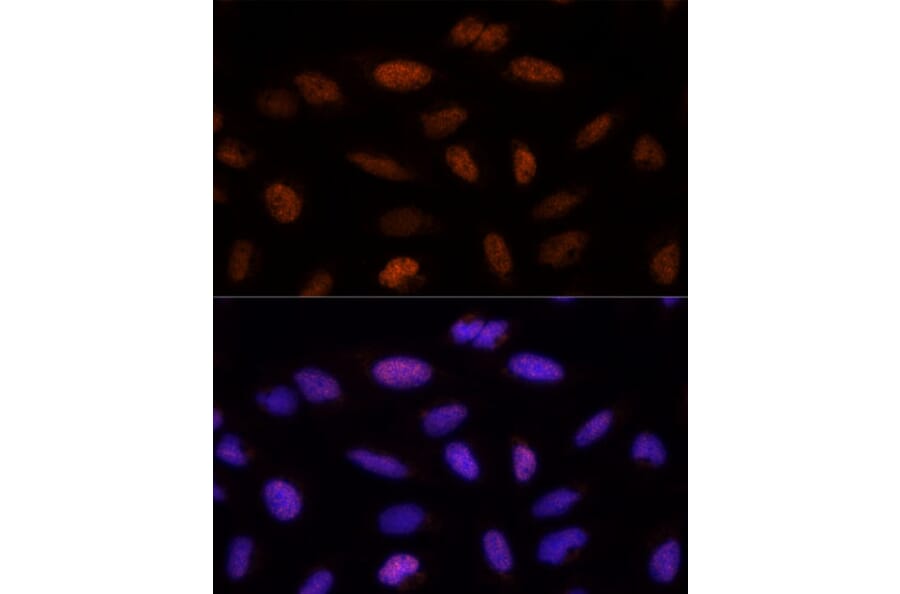 Immunofluorescence - Anti-ADNP Antibody (A11766) - Antibodies.com