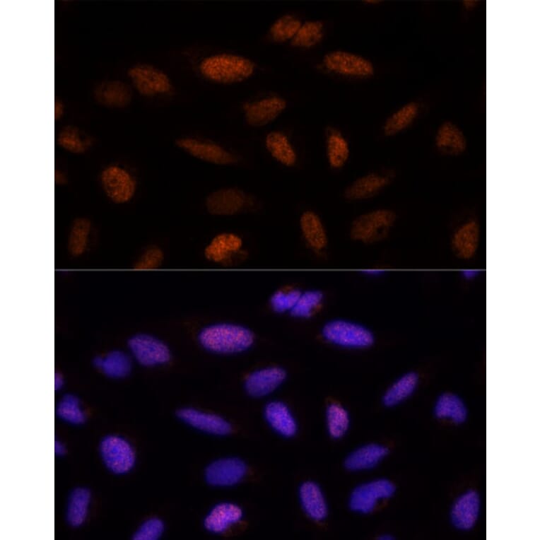 Immunofluorescence - Anti-ADNP Antibody (A11766) - Antibodies.com