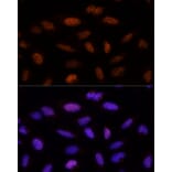 Immunofluorescence - Anti-ADNP Antibody (A11766) - Antibodies.com
