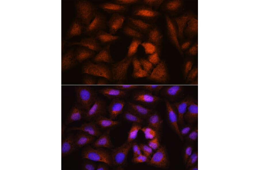 Immunofluorescence - Anti-BRRN1 Antibody (A11767) - Antibodies.com