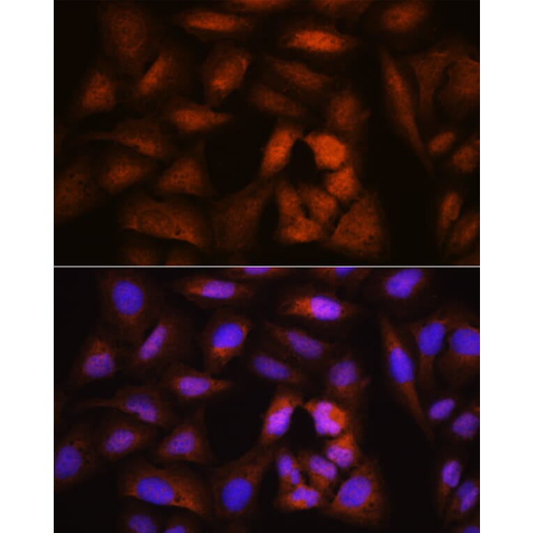 Immunofluorescence - Anti-BRRN1 Antibody (A11767) - Antibodies.com