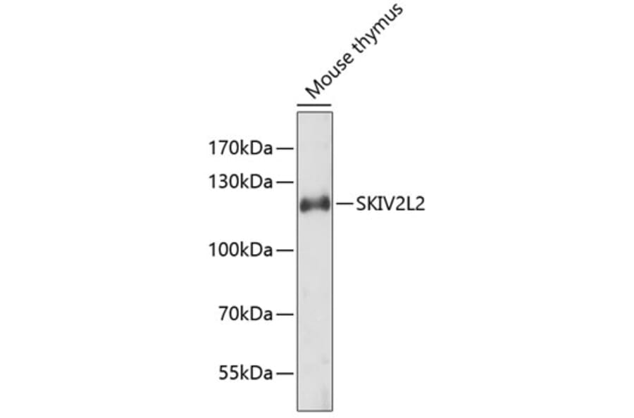 Western Blot - Anti-SKIV2L2 Antibody (A4560) - Antibodies.com