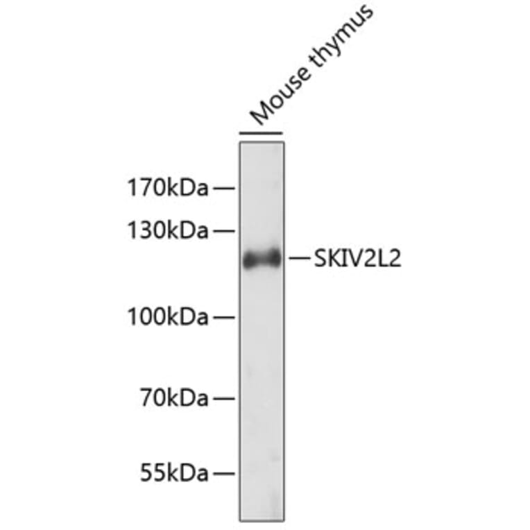 Western Blot - Anti-SKIV2L2 Antibody (A4560) - Antibodies.com
