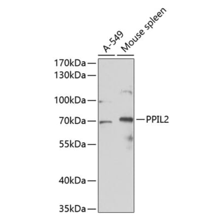Western Blot - Anti-PPIL2 Antibody (A11771) - Antibodies.com