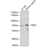 Western Blot - Anti-PPIL2 Antibody (A11771) - Antibodies.com
