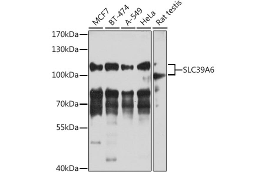 Western Blot - Anti-SLC39A6/ZIP-6 Antibody (A11772) - Antibodies.com